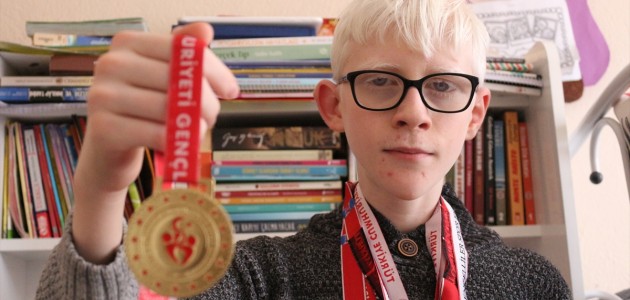 Hüseyin Ali, Albinizme Rağmen Azmiyle Örnek Oluyor