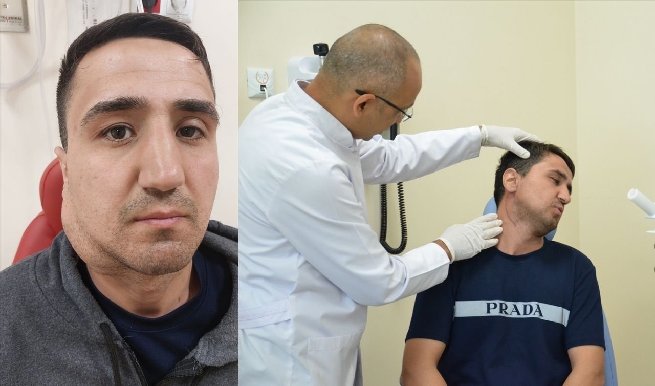 Konya’da yaşayan adam yüzündeki dev kitleden 5 saatte kurtuldu 