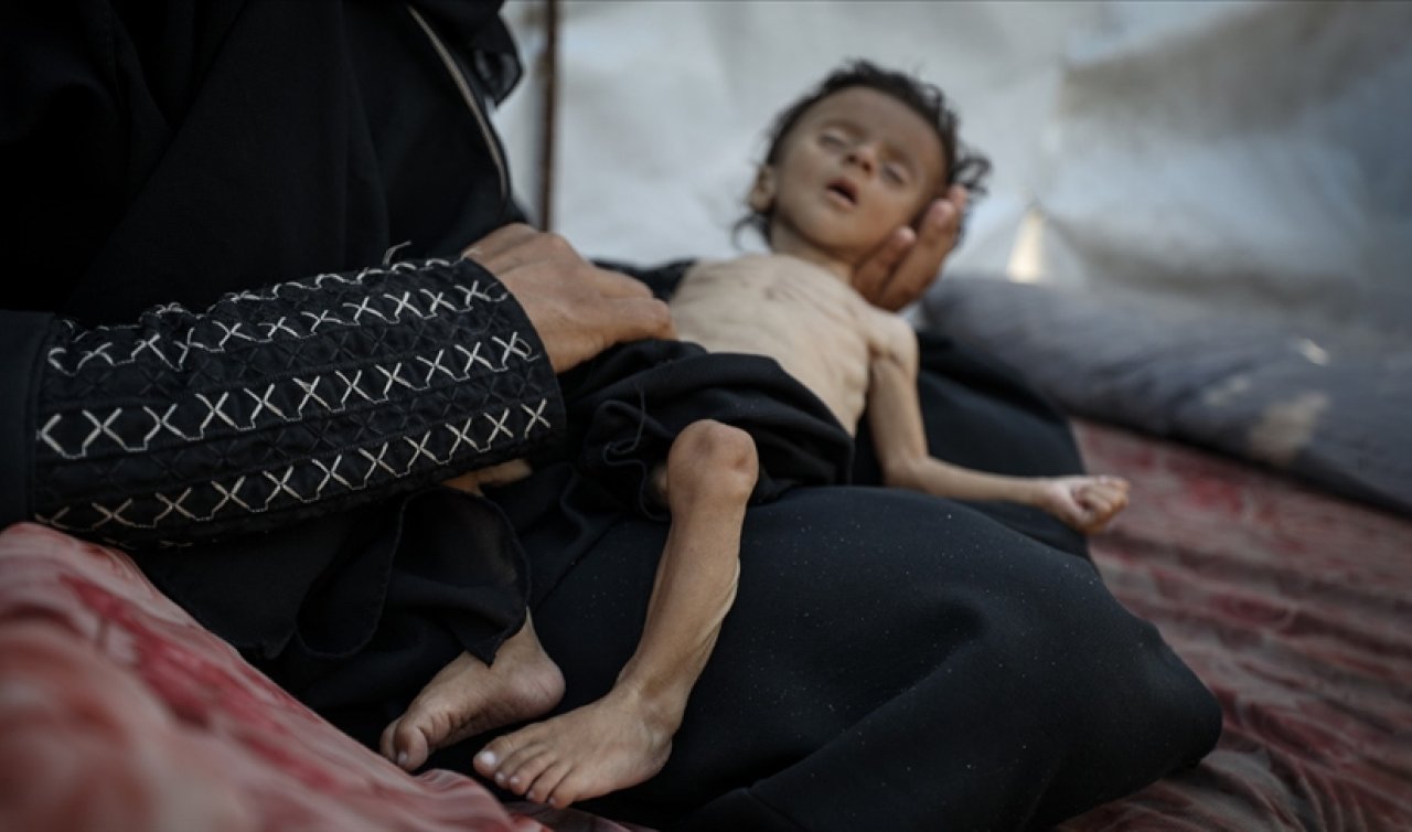 İsrail’in kıtlığı dayattığı Gazze Şeridi’nde son 24 saatte 11 kişi daha açlıktan hayatını kaybetti