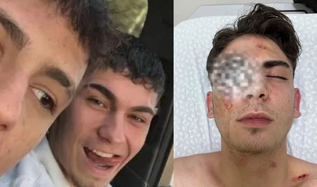 Muştayla dövüldü, gözünü kaybetti… Konya’da tahliye sonrası tepki çeken pozlar