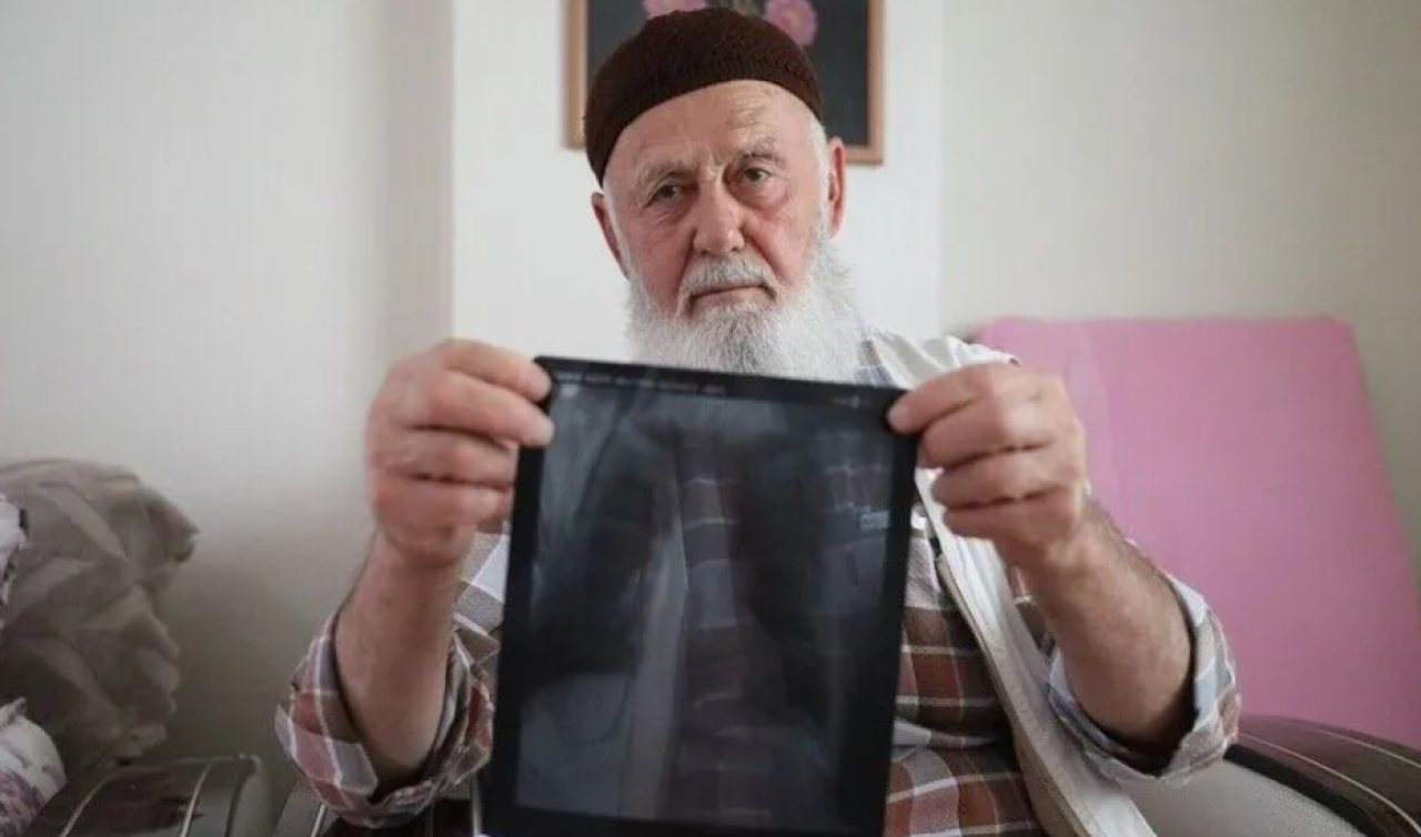 Sigara nedeniyle 3 parmağını kaybeden Osman dede pişmanlığını anlattı